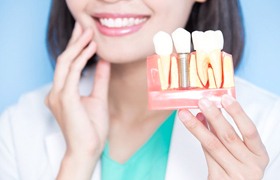 Implant dentist in Aurora holding model for dental implants