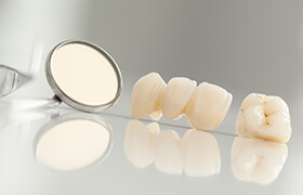 Dental crown and bridge on tray