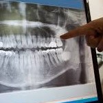 Person pointing to dental X rays