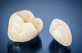 Custom dental crowns outside of mouth