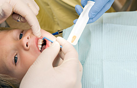 Child receiving fluoride treatment