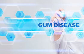 gum disease