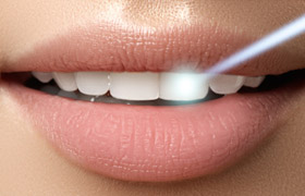 laser dentistry