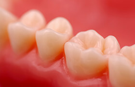 Closeup of tooth with dental crown