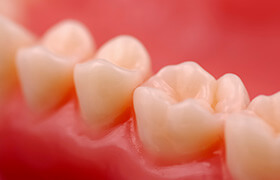 Closeup of tooth with dental crown