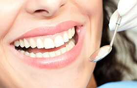 Closeup of teeth during dental checkup