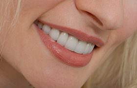 Closeup of healthy beautiful smile