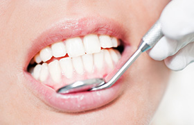 Closeup of gums being examined