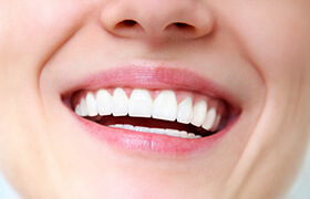 Closeup of whole healthy smile