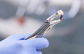Metal forceps with extracted tooth