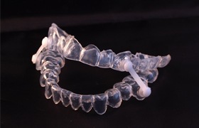 A sleep apnea oral appliance