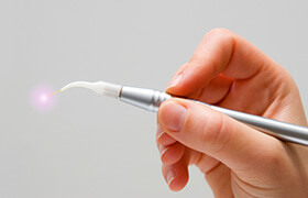 Dental laser wand