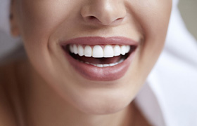 closeup smiling for cost of veneers in Aurora 