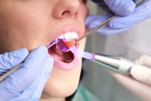 dentist using light-based therapy