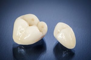 Image of all-ceramic dental crowns in Aurora.