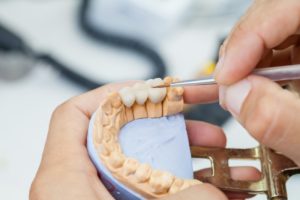 dentist in Aurora creating a dental bridge 