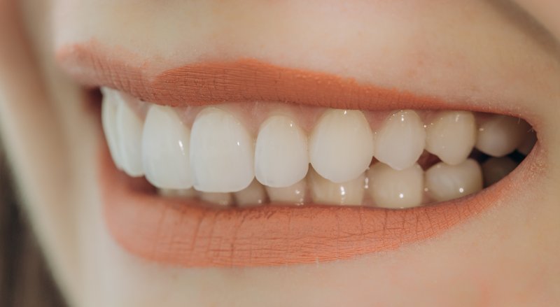 Dental patient wearing porcelain veneers