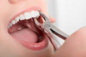 a woman getting a tooth removed from her mouth